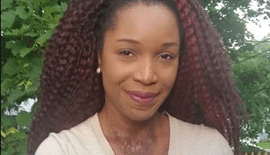 Her Journey to Medical School Began at the Burn Camp