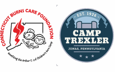 CBCF Announces New Home for Arthur C. Luf Children’s Burn Camp