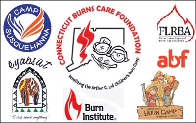 CBCF Launches Nationwide “Burn Camp Share Program”