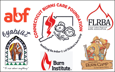 Protected: CBCF Launches Nationwide “Burn Camp Share Program”