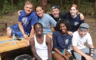 Killingworth camp helps child burn survivors