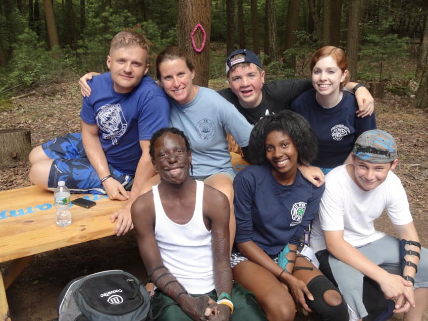 Killingworth camp helps child burn survivors